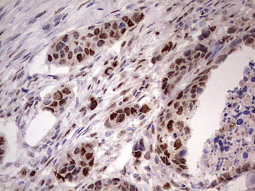 m06449 anti appbp1 nae1 mouse monoclonal antibody clone id oti1e10 ihc testing 4