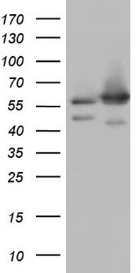 HEK293T cells were transfected with the pCMV6-ENTRY control (Left lane) or pCMV6-ENTRY NAE1 (Right lane) cDNA for 48 hrs and lysed