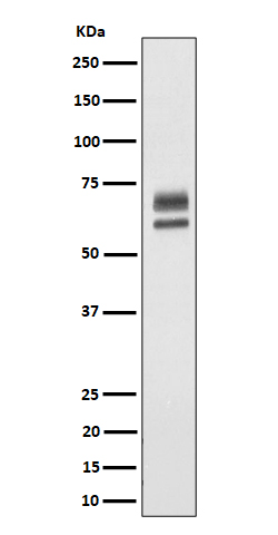 Western blot analysis of PPP2R5D expression in HeLa cell lysate