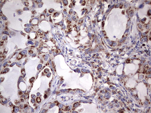 m06450 anti ppp2r5d mouse monoclonal antibody clone id oti5e7 ihc testing 2