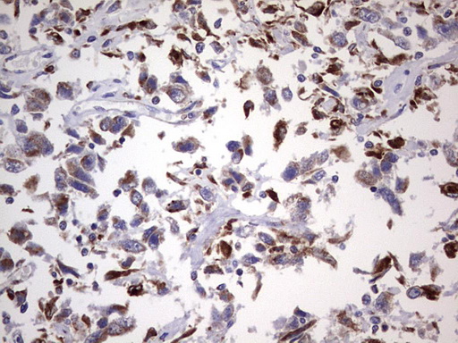 m06450 anti ppp2r5d mouse monoclonal antibody clone id oti5e7 ihc testing 3
