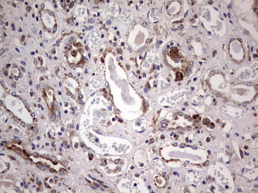 m06450 anti ppp2r5d mouse monoclonal antibody clone id oti5e7 ihc testing 4