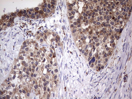 m06450 anti ppp2r5d mouse monoclonal antibody clone id oti5e7 ihc testing 5