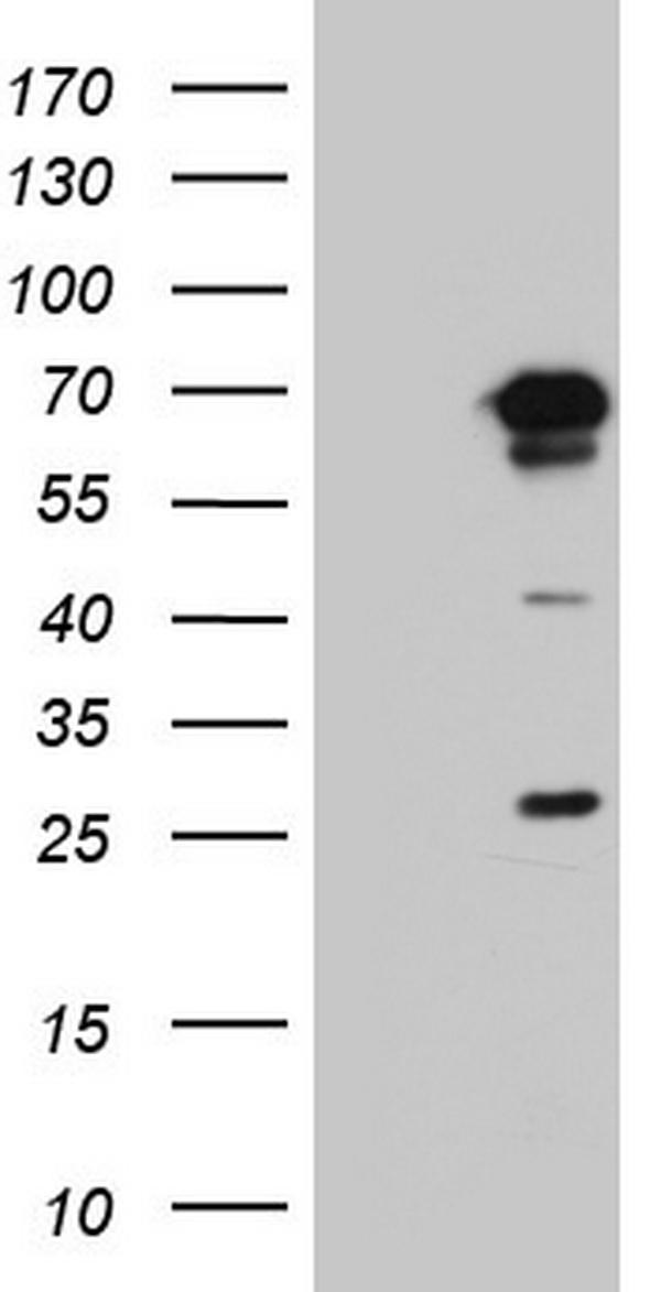 m06450 anti ppp2r5d mouse monoclonal antibody clone id oti5e7 wb testing 1