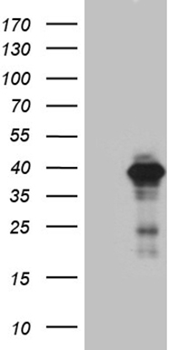 HEK293T cells were transfected with the pCMV6-ENTRY control (Left lane) or pCMV6-ENTRY DEDD (Right lane) cDNA for 48 hrs and lysed