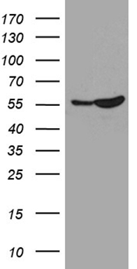HEK293T cells were transfected with the pCMV6-ENTRY control (Left lane) or pCMV6-ENTRY SMARCD3 (Right lane) cDNA for 48 hrs and lysed