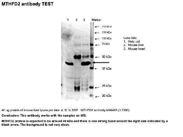 m06465 mthfd2 primary antibodies wb testing 2