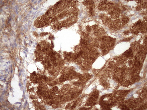 Immunohistochemical staining of paraffin-embedded Human Ovary tissue within the normal limits using anti-FGFBP1 mouse monoclonal antibody