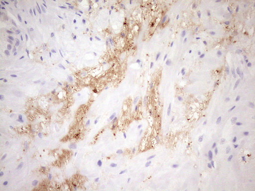 Immunohistochemical staining of paraffin-embedded Human prostate tissue within the normal limits using anti-FGFBP1 mouse monoclonal antibody