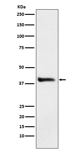 Western blot analysis of Alcohol Dehydrogenase expression in HepG2 cell lysate
