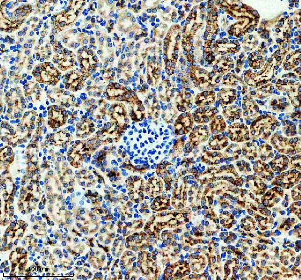 IHC analysis of Legumain/LGMN using anti-Legumain/LGMN antibody (M06476)