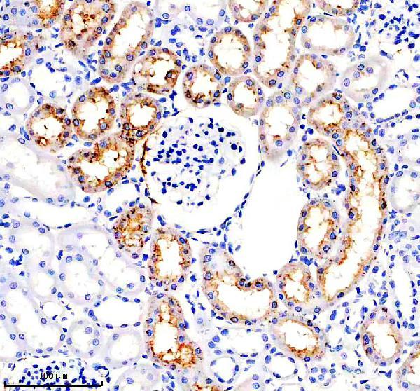 IHC analysis of Legumain/LGMN using anti-Legumain/LGMN antibody (M06476)
