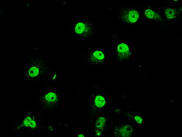 m06479 anti trib2 mouse monoclonal antibody clone id oti8d11 if testing 11
