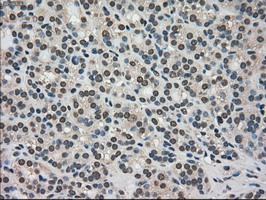 m06479 anti trib2 mouse monoclonal antibody clone id oti8d11 ihc testing 4