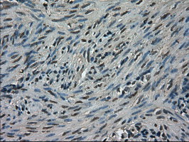 m06479 anti trib2 mouse monoclonal antibody clone id oti8d11 ihc testing 5
