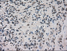 m06479 anti trib2 mouse monoclonal antibody clone id oti8d11 ihc testing 6