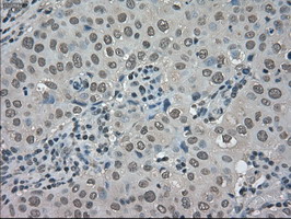 m06479 anti trib2 mouse monoclonal antibody clone id oti8d11 ihc testing 7