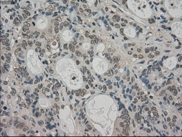 m06479 anti trib2 mouse monoclonal antibody clone id oti8d11 ihc testing 8