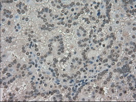 m06479 anti trib2 mouse monoclonal antibody clone id oti8d11 ihc testing 9
