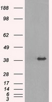 HEK293T cells were transfected with the pCMV6-ENTRY control (Left lane) or pCMV6-ENTRY TRIB2 (Right lane) cDNA for 48 hrs and lysed