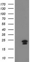 HEK293T cells were transfected with the pCMV6-ENTRY control (Left lane) or pCMV6-ENTRY HAND1 (Right lane) cDNA for 48 hrs and lysed