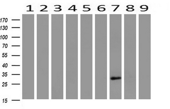 Western blot analysis of extracts (10ug) from 9 Human tissue by using anti-HAND1 monoclonal antibody at 1:200 (1: Testis; 2: Omentum; 3: Uterus; 4: Breast; 5: Brain; 6: Liver; 7: Ovary; 8: Thyroid gland; 9: colon)