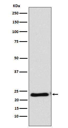 Western blot analysis of RAIDD expression in HeLa cell lysate