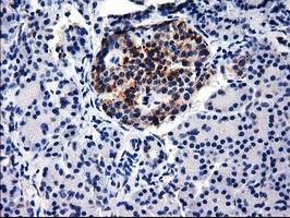 m06524 anti ggps1 mouse monoclonal antibody clone id oti3f9 ihc testing 3