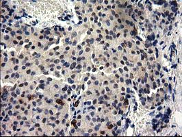 m06524 anti ggps1 mouse monoclonal antibody clone id oti3f9 ihc testing 4