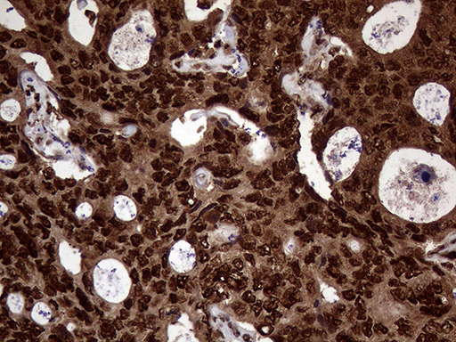 m06530 anti transaldolase 1 taldo1 mouse monoclonal antibody clone id oti2e4 ihc testing 10