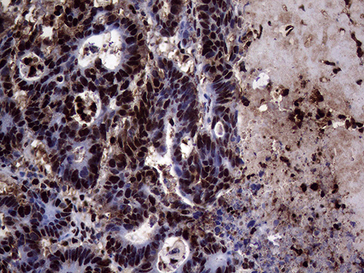 m06530 anti transaldolase 1 taldo1 mouse monoclonal antibody clone id oti2e4 ihc testing 11