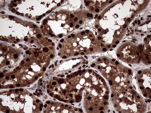m06530 anti transaldolase 1 taldo1 mouse monoclonal antibody clone id oti2e4 ihc testing 12