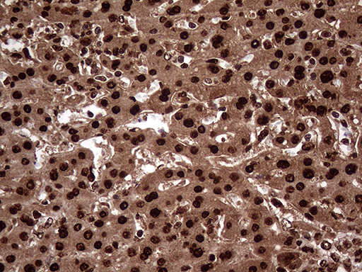 m06530 anti transaldolase 1 taldo1 mouse monoclonal antibody clone id oti2e4 ihc testing 13