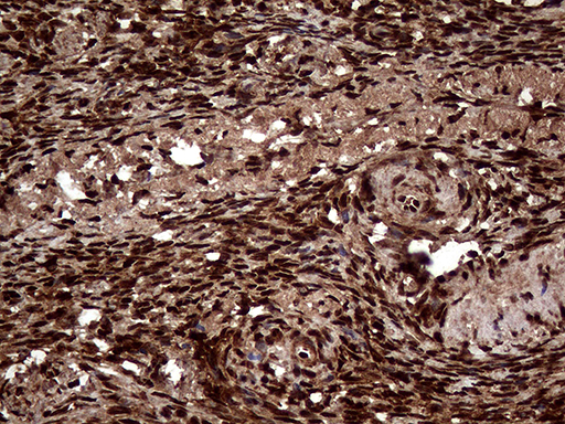 m06530 anti transaldolase 1 taldo1 mouse monoclonal antibody clone id oti2e4 ihc testing 4