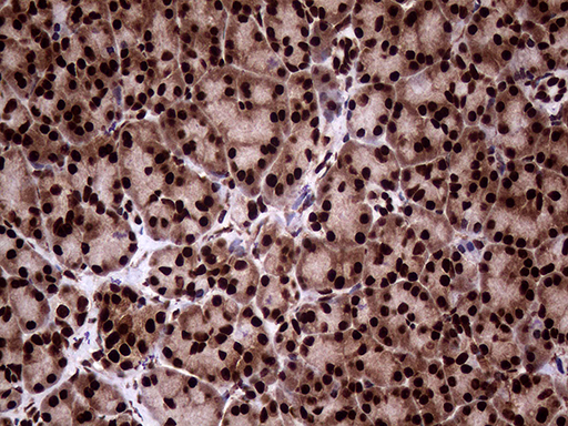 m06530 anti transaldolase 1 taldo1 mouse monoclonal antibody clone id oti2e4 ihc testing 5