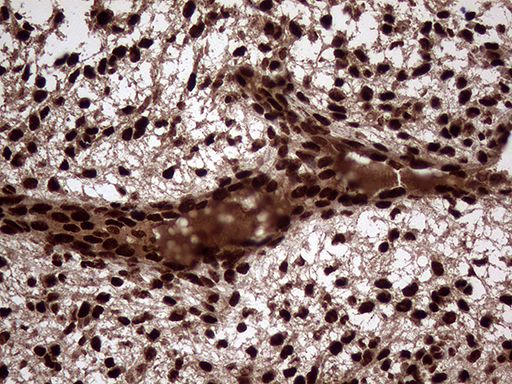m06530 anti transaldolase 1 taldo1 mouse monoclonal antibody clone id oti2e4 ihc testing 6