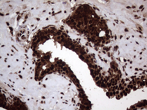 m06530 anti transaldolase 1 taldo1 mouse monoclonal antibody clone id oti2e4 ihc testing 7
