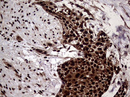 m06530 anti transaldolase 1 taldo1 mouse monoclonal antibody clone id oti2e4 ihc testing 8