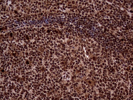 m06530 anti transaldolase 1 taldo1 mouse monoclonal antibody clone id oti2e4 ihc testing 9