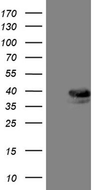 HEK293T cells were transfected with the pCMV6-ENTRY control (Left lane) or pCMV6-ENTRY TALDO1 (Right lane) cDNA for 48 hrs and lysed