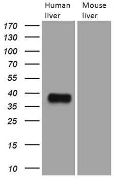 Western blot analysis of extracts (35ug) from 2 different tissue lysates by using anti-TALDO1 monoclonal antibody (1:500)