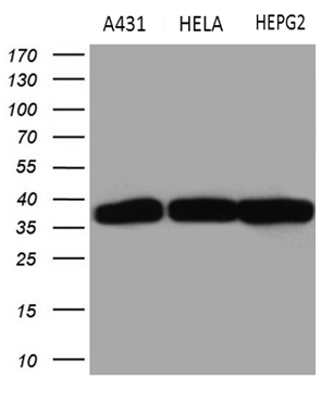 Western blot analysis of extracts (35ug) from 3different cell lines by using anti-TALDO1 monoclonal antibody (1:500)