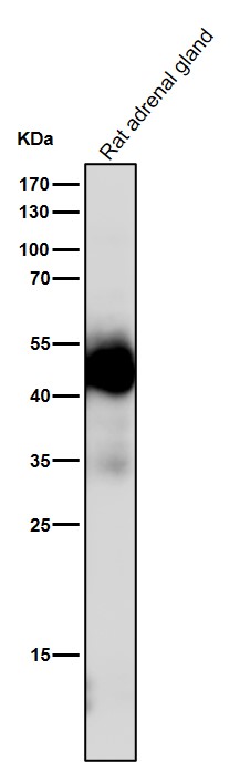 Immunohistochemical analysis of paraffin-embedded human bladder, using Uroplakin III Antibody. Immunohistochemical analysis of paraffin-embedded human bladder, using Uroplakin III Antibody.