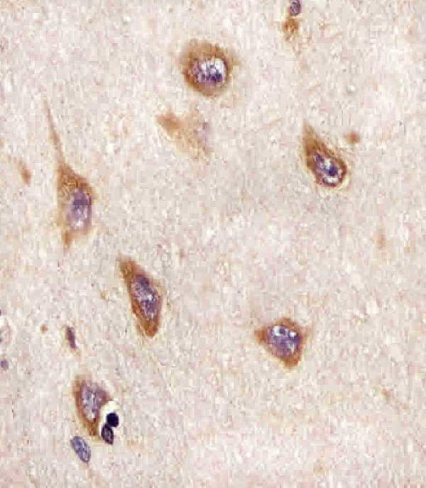 m06539 1 anti atg4a antibody ihc p testing 3