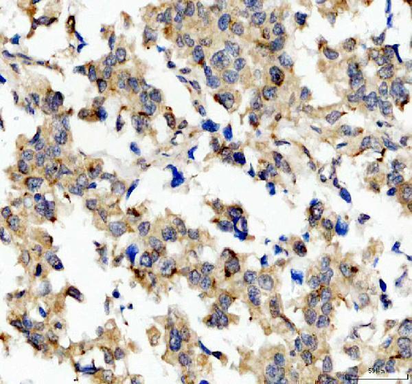 IHC analysis of FSP1/AIFM2/MRC1 using anti-FSP1/AIFM2/MRC1 antibody (M06541)