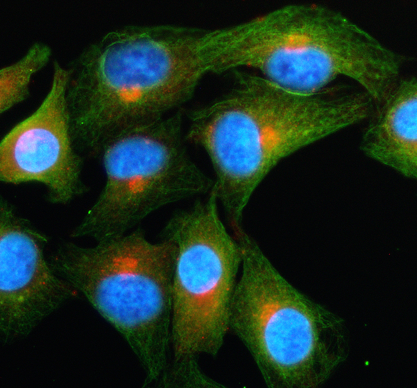 m06541 fsp1 primary antibodies if testing 1
