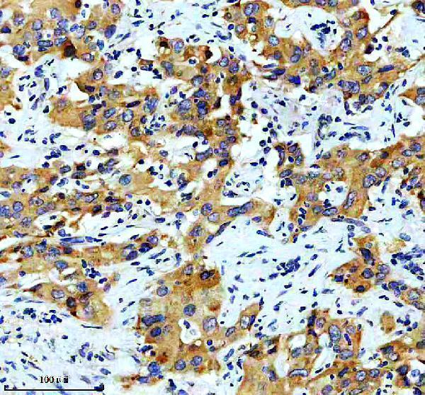 IHC analysis of FSP1 using anti-FSP1 antibody (M06541)