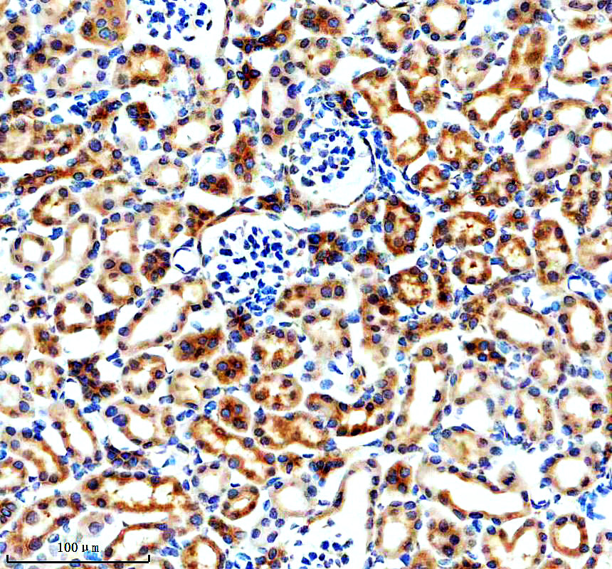 m06541 fsp1 primary antibodies ihc testing 3