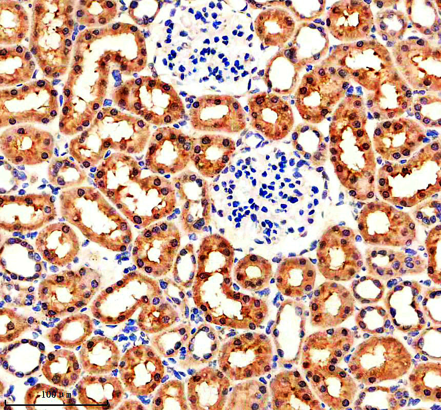 m06541 fsp1 primary antibodies ihc testing 4