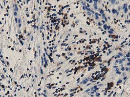 m06548 anti growth arrest specific protein 7 gas7 mouse monoclonal antibody clone id oti8h10 ihc testing 4